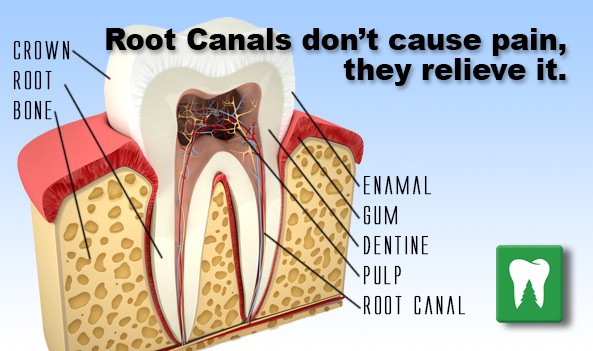Root canals don't cause pain, they relieve it.