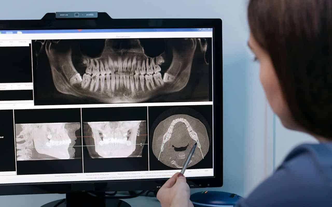 A Dentist Explaining Dental Results
